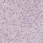 KIAA1324 Antibody in Immunohistochemistry (IHC)