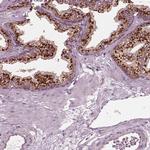 KIAA1324 Antibody in Immunohistochemistry (IHC)