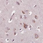 KIAA1324 Antibody in Immunohistochemistry (IHC)