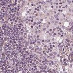 KIAA1324 Antibody in Immunohistochemistry (IHC)