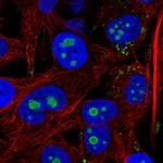 ACSL3 Antibody in Immunocytochemistry (ICC/IF)