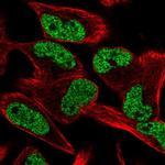 CCM2L Antibody in Immunocytochemistry (ICC/IF)