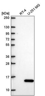 ITGB1BP1 Antibody in Western Blot (WB)