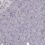 Cyclin F Antibody in Immunohistochemistry (IHC)