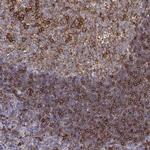 Cyclin F Antibody in Immunohistochemistry (IHC)