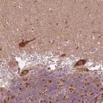 SLC25A5 Antibody in Immunohistochemistry (Paraffin) (IHC (P))