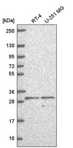 SLC25A5 Antibody in Western Blot (WB)