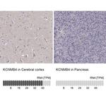 KCNMB4 Antibody in Immunohistochemistry (IHC)