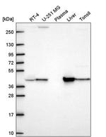 GOT1 Antibody in Western Blot (WB)