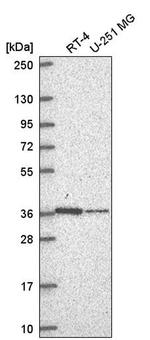 NDUFA9 Antibody in Western Blot (WB)