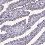 KIF19 Antibody in Immunohistochemistry (IHC)