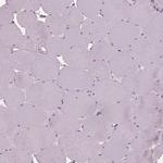 Sorcin Antibody in Immunohistochemistry (IHC)