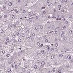 Sorcin Antibody in Immunohistochemistry (IHC)