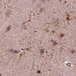 Sorcin Antibody in Immunohistochemistry (IHC)