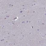 FEZF1 Antibody in Immunohistochemistry (IHC)