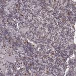 NUP37 Antibody in Immunohistochemistry (IHC)