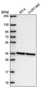 NUP37 Antibody in Western Blot (WB)