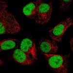 ORC2 Antibody in Immunocytochemistry (ICC/IF)