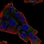 NAT8 Antibody in Immunocytochemistry (ICC/IF)