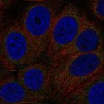 GPR89A Antibody in Immunocytochemistry (ICC/IF)