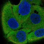 IRF6 Antibody in Immunocytochemistry (ICC/IF)