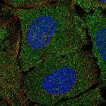 Mgea5 Antibody in Immunocytochemistry (ICC/IF)