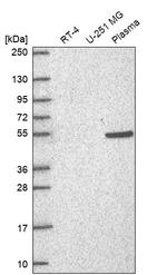 RAPGEF5 Antibody in Western Blot (WB)