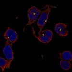 TRIM34 Antibody in Immunocytochemistry (ICC/IF)