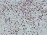 Phospho-beta Catenin (Ser715) Antibody in Immunohistochemistry (Paraffin) (IHC (P))