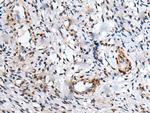 UBE2W Antibody in Immunohistochemistry (Paraffin) (IHC (P))