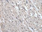 UBE2W Antibody in Immunohistochemistry (Paraffin) (IHC (P))