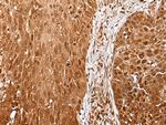 UBE1L Antibody in Immunohistochemistry (Paraffin) (IHC (P))