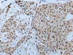 HOXD10 Antibody in Immunohistochemistry (Paraffin) (IHC (P))