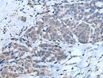 MTHFR Antibody in Immunohistochemistry (Paraffin) (IHC (P))