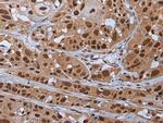 YY2 Antibody in Immunohistochemistry (Paraffin) (IHC (P))