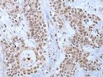 YY2 Antibody in Immunohistochemistry (Paraffin) (IHC (P))