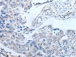 UBR4 Antibody in Immunohistochemistry (Paraffin) (IHC (P))