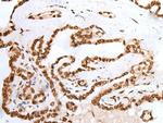 PIF1 Antibody in Immunohistochemistry (Paraffin) (IHC (P))