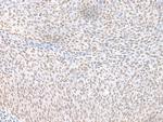 ECT2 Antibody in Immunohistochemistry (Paraffin) (IHC (P))