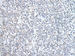 ABCD1 Antibody in Immunohistochemistry (Paraffin) (IHC (P))