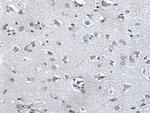 HAND1 Antibody in Immunohistochemistry (Paraffin) (IHC (P))