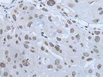 HAND1 Antibody in Immunohistochemistry (Paraffin) (IHC (P))