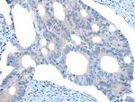 UNC5B Antibody in Immunohistochemistry (Paraffin) (IHC (P))