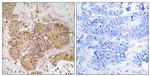 LUC7L2 Antibody in Immunohistochemistry (Paraffin) (IHC (P))