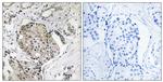 USP40 Antibody in Immunohistochemistry (Paraffin) (IHC (P))