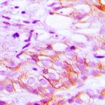 LRP2 Antibody in Immunohistochemistry (Paraffin) (IHC (P))