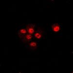 TRIP10 Antibody in Immunocytochemistry (ICC/IF)