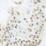 ZBTB17 Antibody in Immunohistochemistry (Paraffin) (IHC (P))