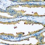 CYP46A1 Antibody in Immunohistochemistry (Paraffin) (IHC (P))