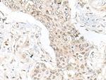 ASXL1 Antibody in Immunohistochemistry (Paraffin) (IHC (P))